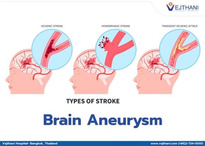 Can skydiving cause a brain aneurysm?