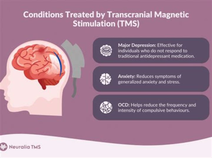 Can stress bring on CFS?
