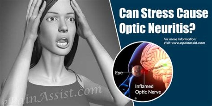 Can stress cause optic neuritis?