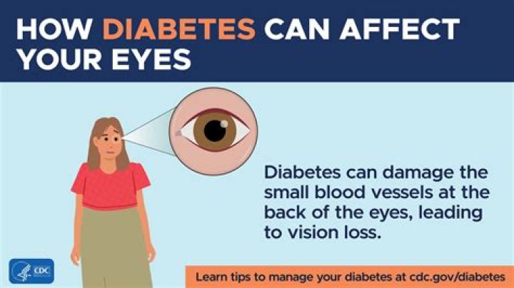 Can you go blind from alcohol in your eye?