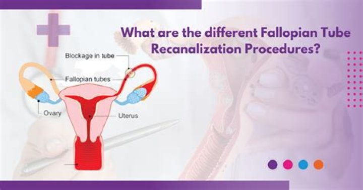 Can you still ovulate if your fallopian tubes are blocked?