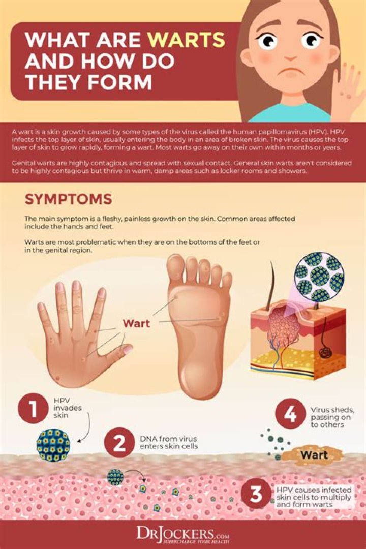 Do eggs cause warts?