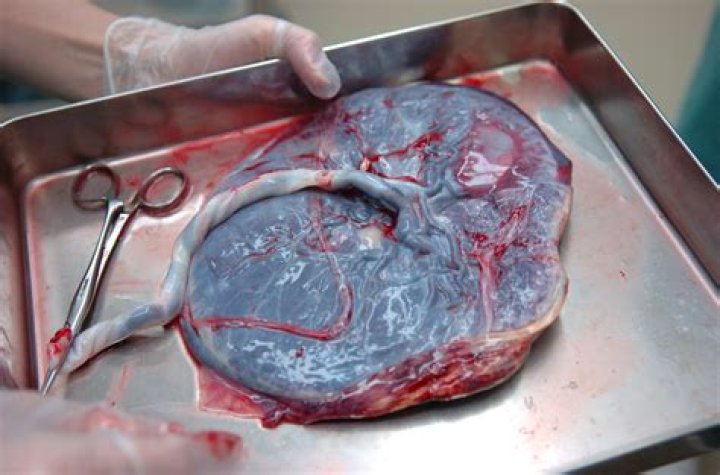 Do people in China eat placenta?