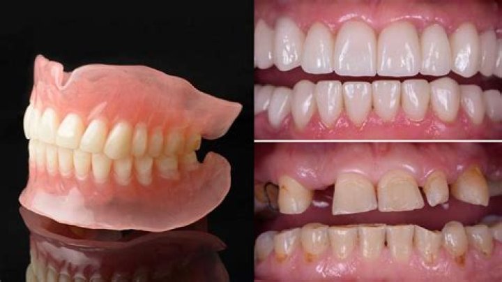 Do permanent dentures look natural?