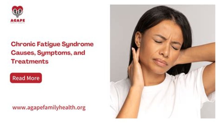 Does a rheumatologist treat chronic fatigue syndrome?