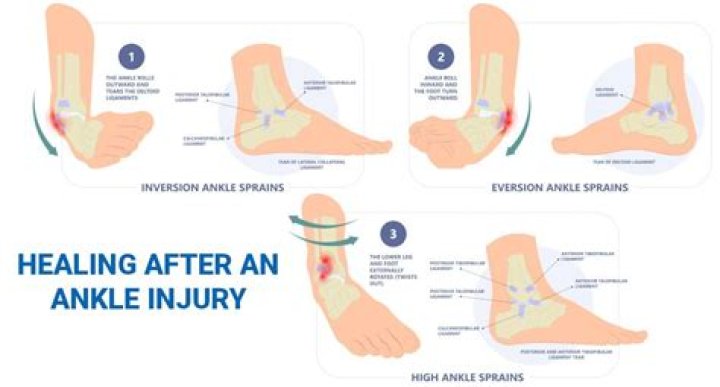 How can u tell if u broke ur ankle?