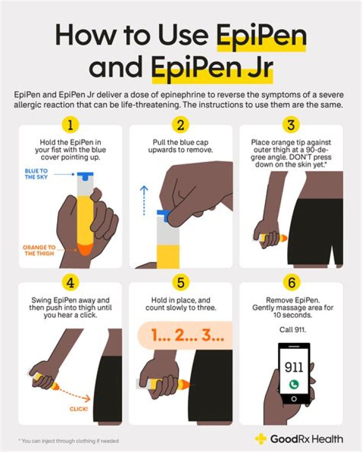 How do I know if I need an EpiPen?