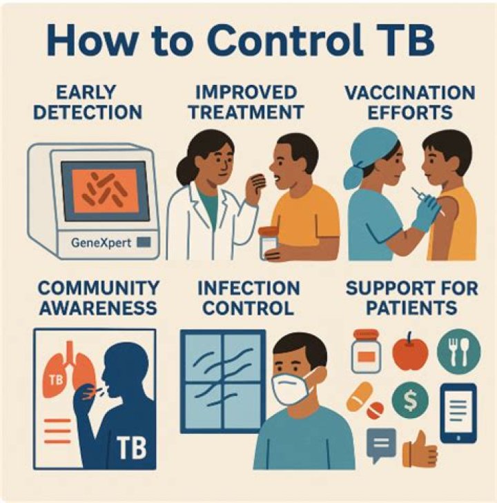 How do TB symptoms start?