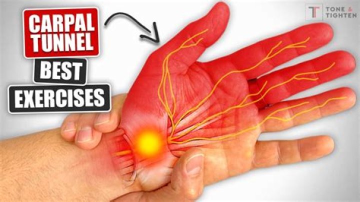 How do you get rid of carpal tunnel pain fast?