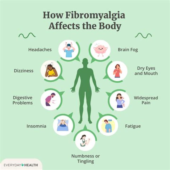 How does a doctor know if you have fibromyalgia?