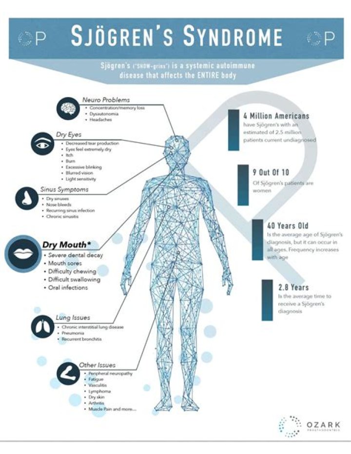 How fast does Sjogren's progress?