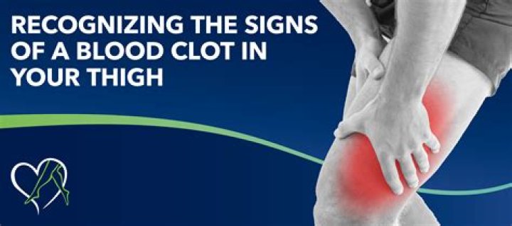 How much should you walk when you have a blood clot in your leg?