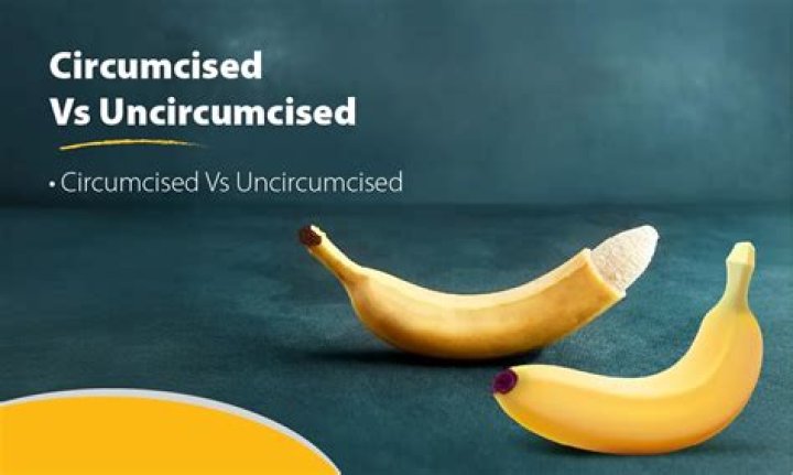 Is it a sin to not be circumcised?