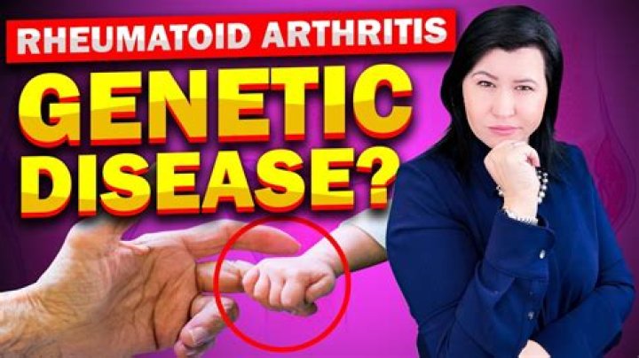 Is rheumatoid arthritis a death sentence?