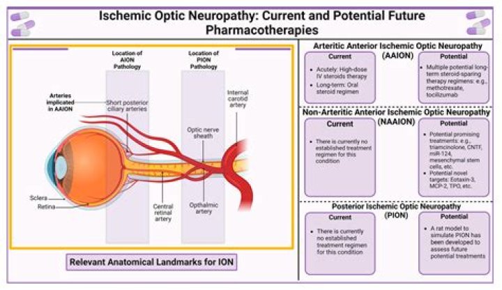 Is there a blood test for optic neuritis?
