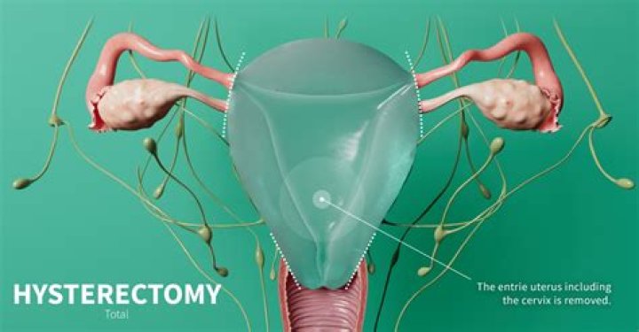Is your vaginal canal shorter after hysterectomy?