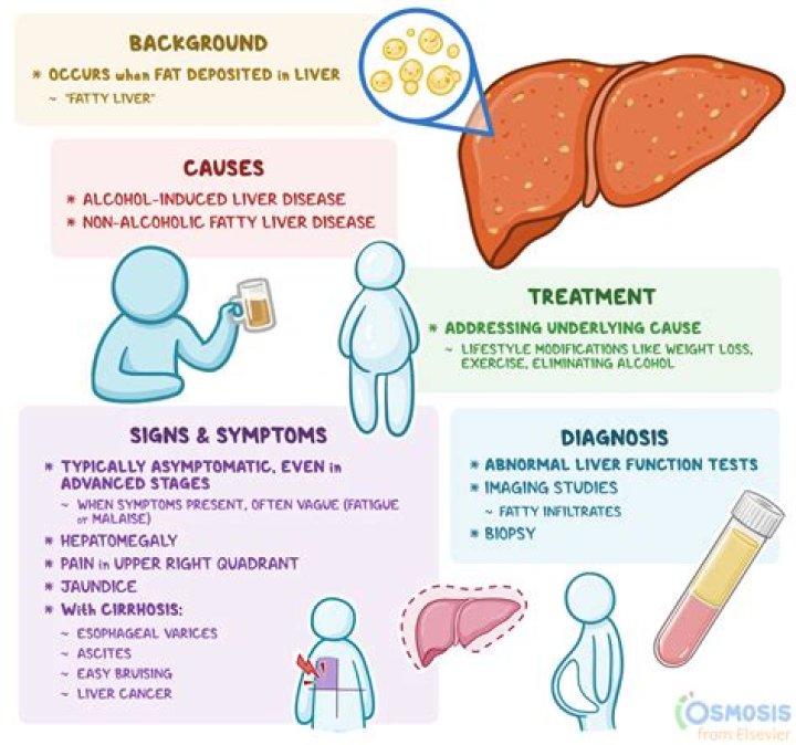 Should I take aspirin if I suspect DVT?