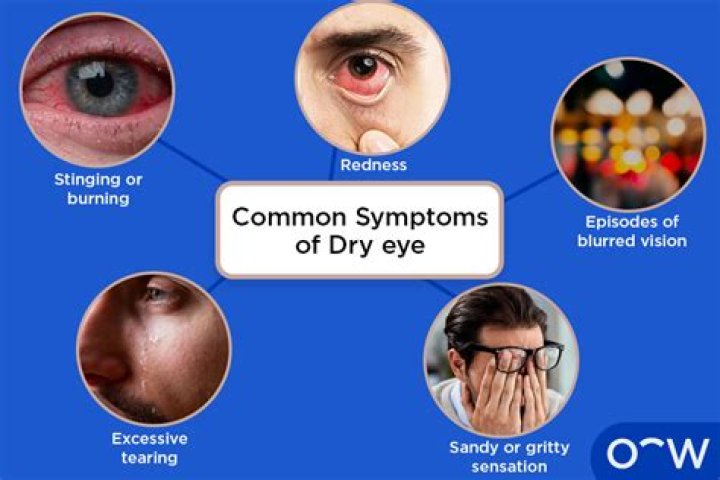 What causes dry eyes?