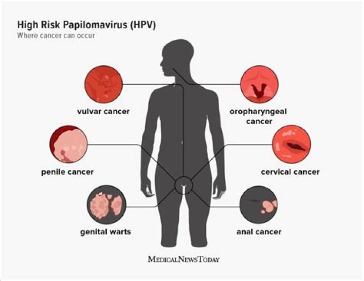 What does high-risk HPV mean?