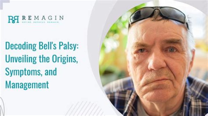 What if Bell's palsy doesn't go away?