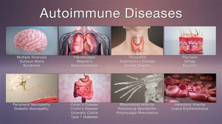 What is the most rare autoimmune disease?