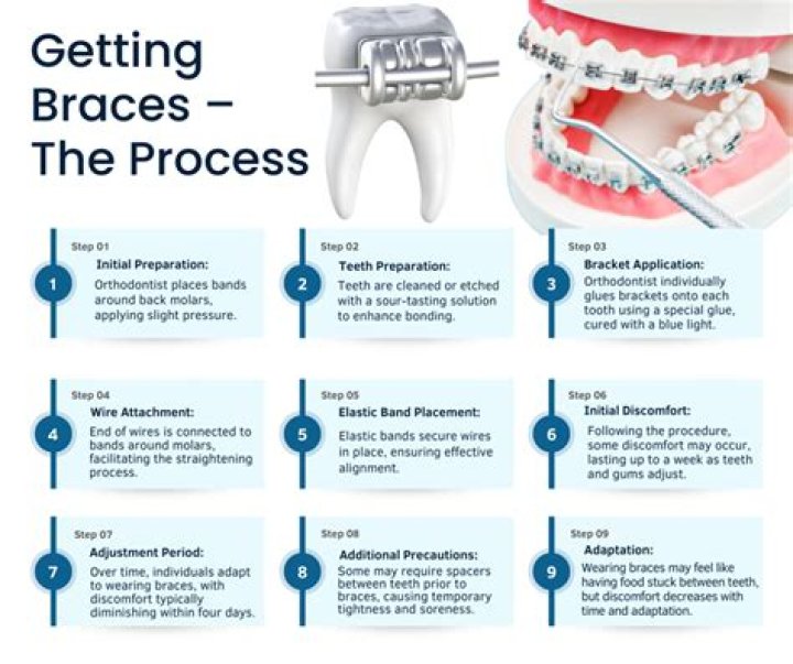 What to expect after getting braces off?