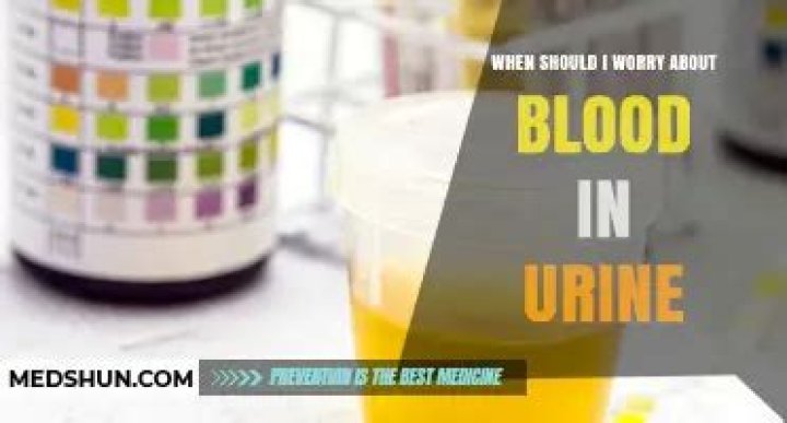When should I worry about blood in urine?