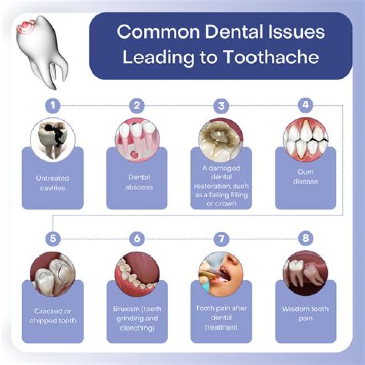 Why are all my teeth aching?