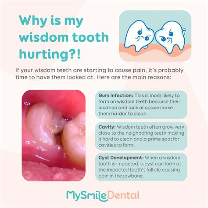 Why are wisdom teeth so big?