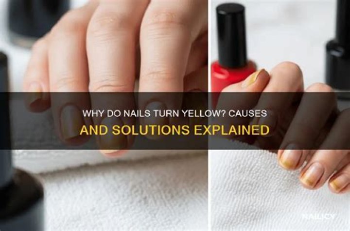 Why do nails turn yellow?